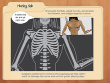 Load image into Gallery viewer, After Bob Marley was shot, he went to the hospital but they left the bullet in his arm to avoid damaging his nerve.